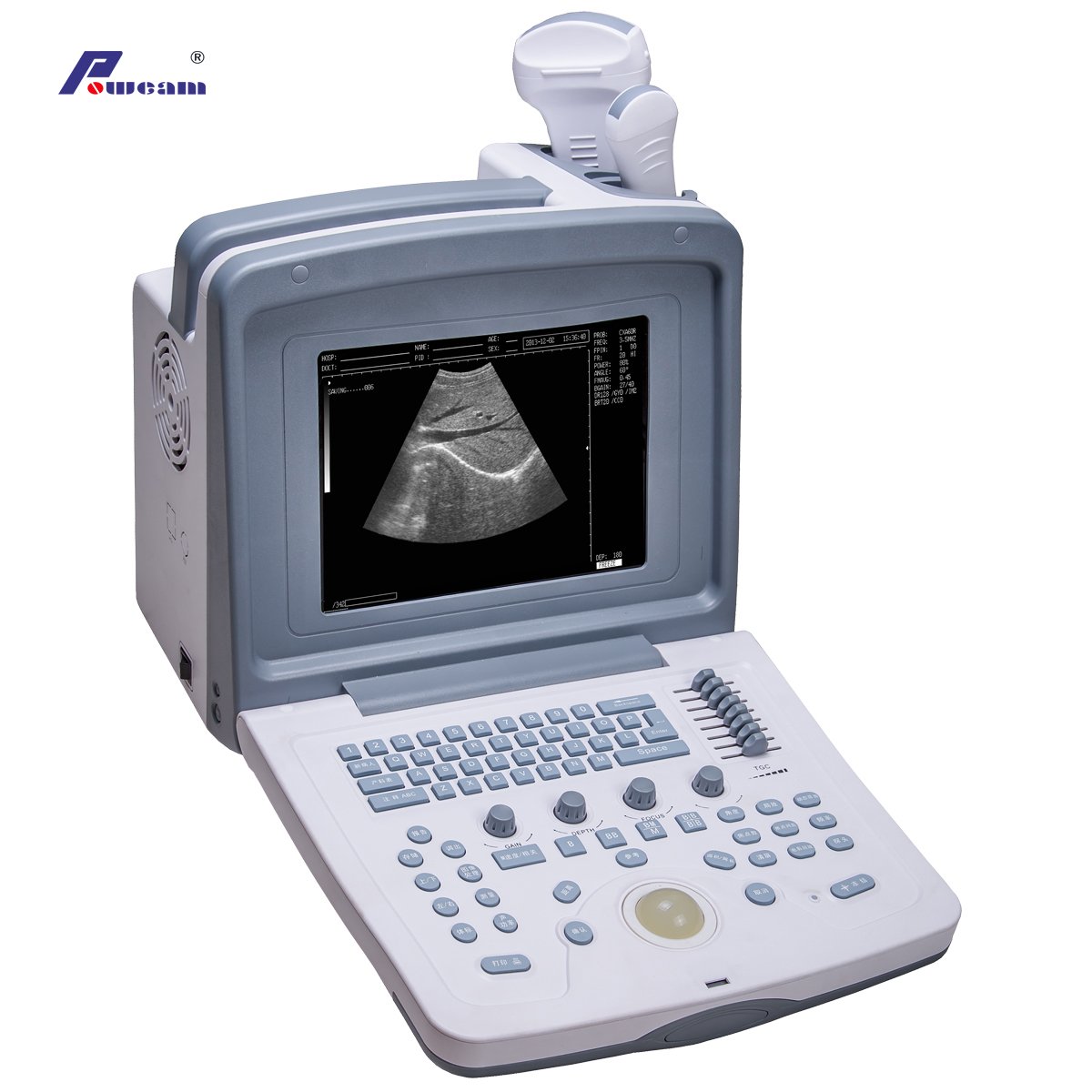 Scanner d'ultrasons numérique portable approuvé CE (WHERC30P)