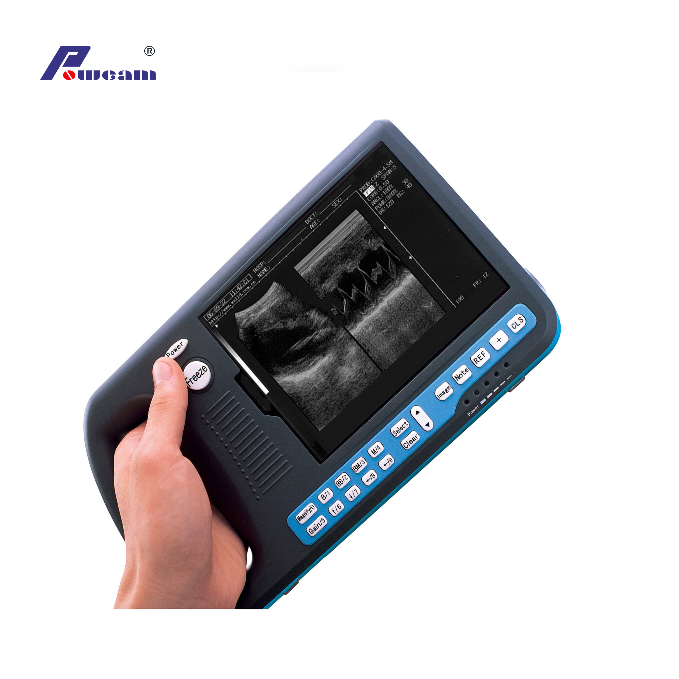 Scanner à ultrasons de PalmTop numérique Hosipital