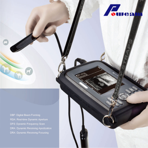 Scanner à ultrasons de l'hôpital Hospital (woyb4000)