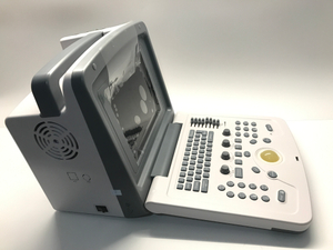 Machine portative de scanner d'ultrason d'ordinateur portable avec le prix de sonde transvaginale linéaire