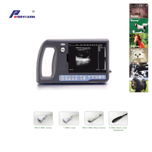 Scanner à ultrasons de palmtop numérique (woyb3000)