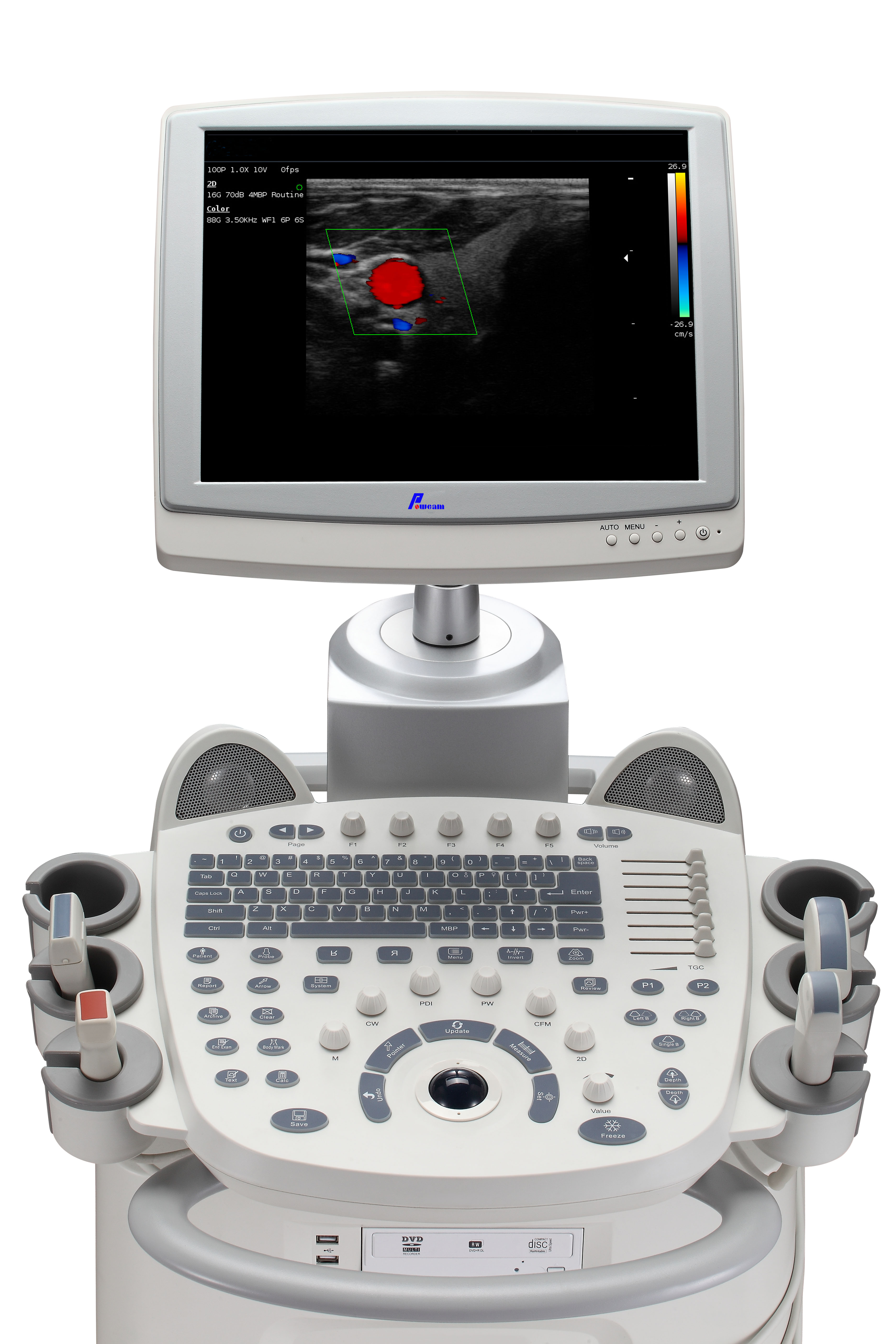 Doppler couleur portable et mobile Sonoscape 4D pour hôpital