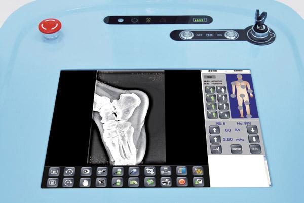 Système de radiographie numérique mobile Haute fréquence DR200