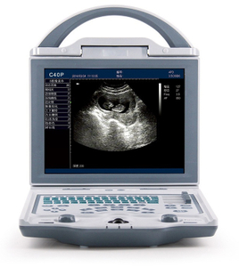Scanner à ultrasons portable pour ordinateur portable Siemens Sonoscape Chison à faible coût