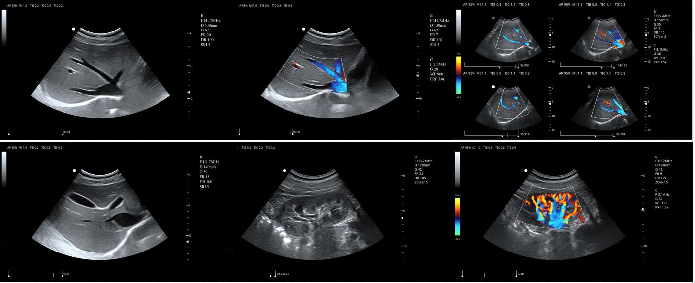 image doppler couleur