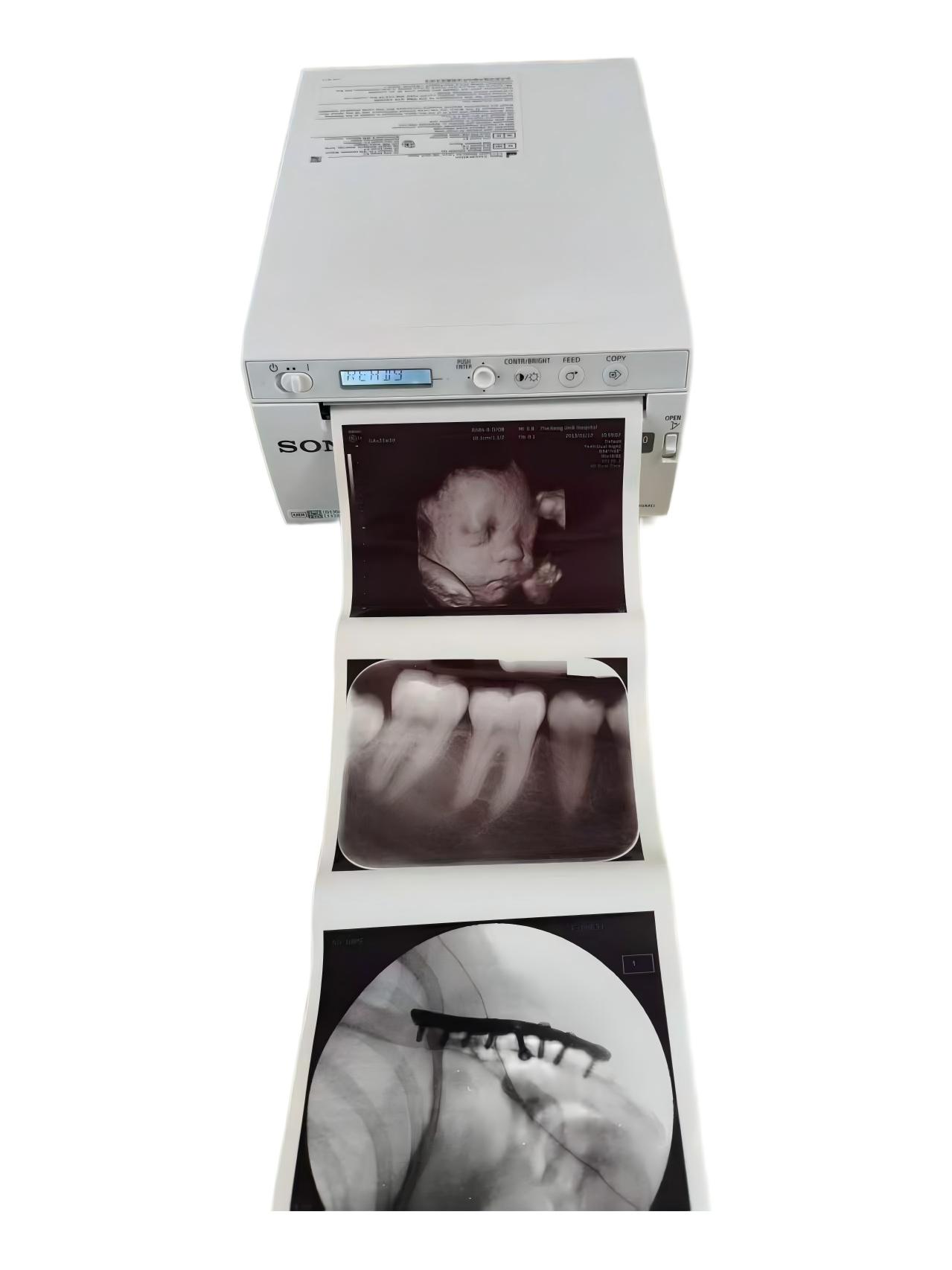 up-X899MD Imprimante graphique thermique hybride numérique noir et blanc pour images échographiques
