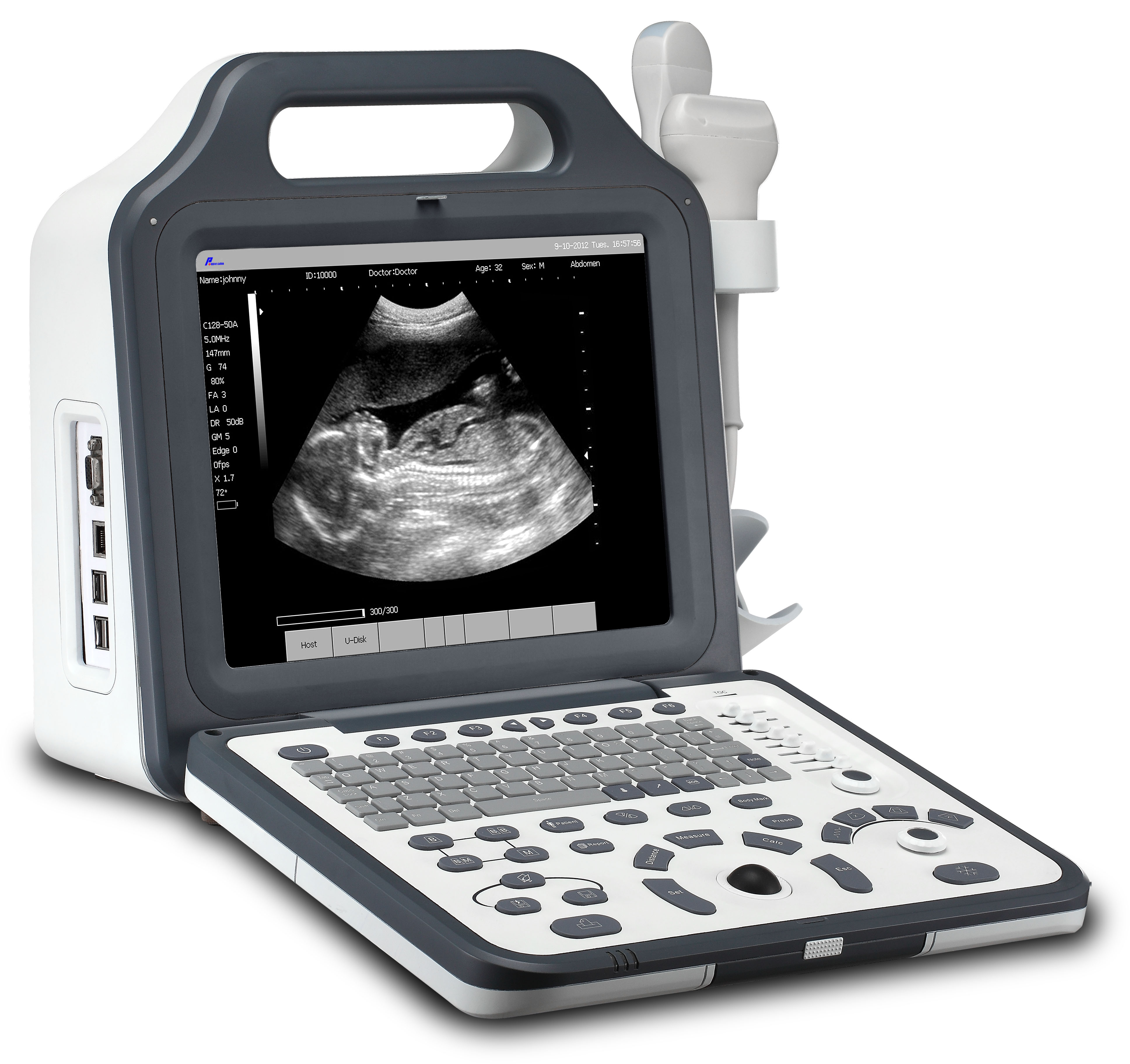 Hôpital approuvé par CE 12.1 "LCD Numérique Ordinateur portable (WHYC60P)