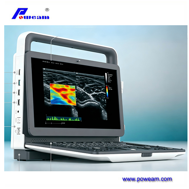 Système de diagnostic Doppler couleur haute performance pour l'imagerie clinique