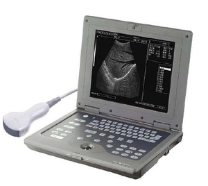 Instruments d'échographie médicale Machine à ultrasons pour ordinateur portable Scanner à ultrasons numérique portable B/W