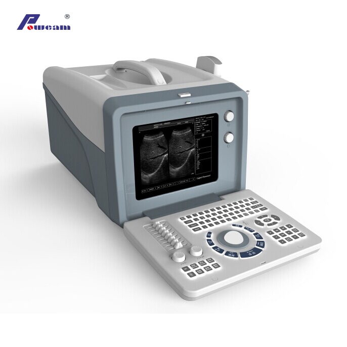 Hospital 12.1 "Ultrason de l'ordinateur portable numérique LCD (whyc60p)