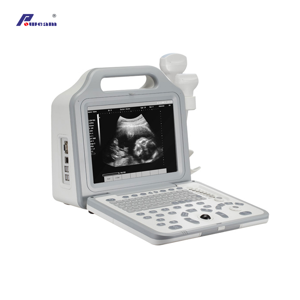 Scanner à ultrasons portable pour ordinateur portable numérique avec écran LCD (WHERC50P)
