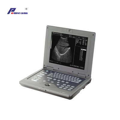 Scanner à ultrasons pour ordinateur portable