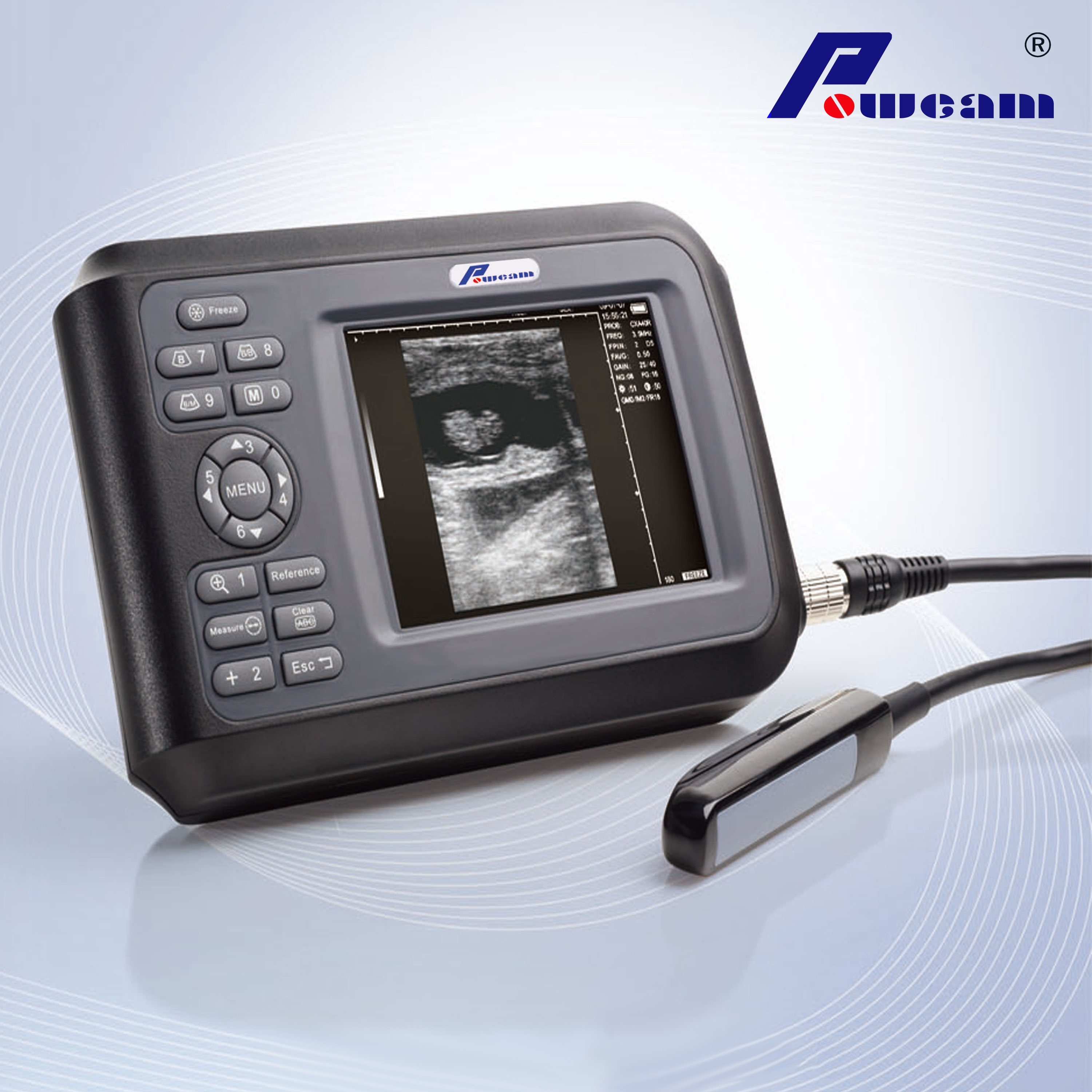 Scanner à ultrasons de l'hôpital Hospital (woyb4000)